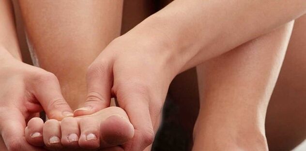 парҳез барои gout